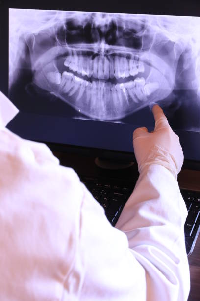 Best Emergency Treatment for Oral Infections in Fond Du Lac, WI